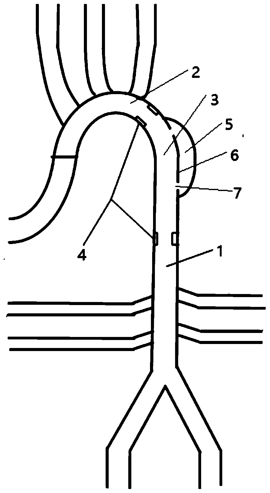 Model building method for dissection of aorta, model and surgery simulation detection method