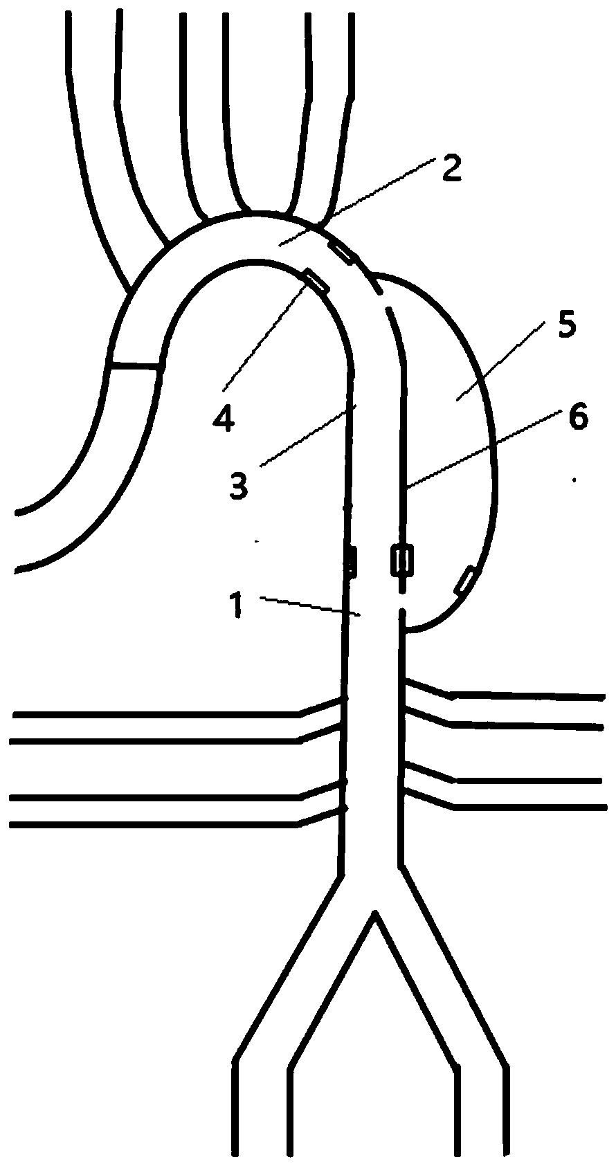 Model building method for dissection of aorta, model and surgery simulation detection method
