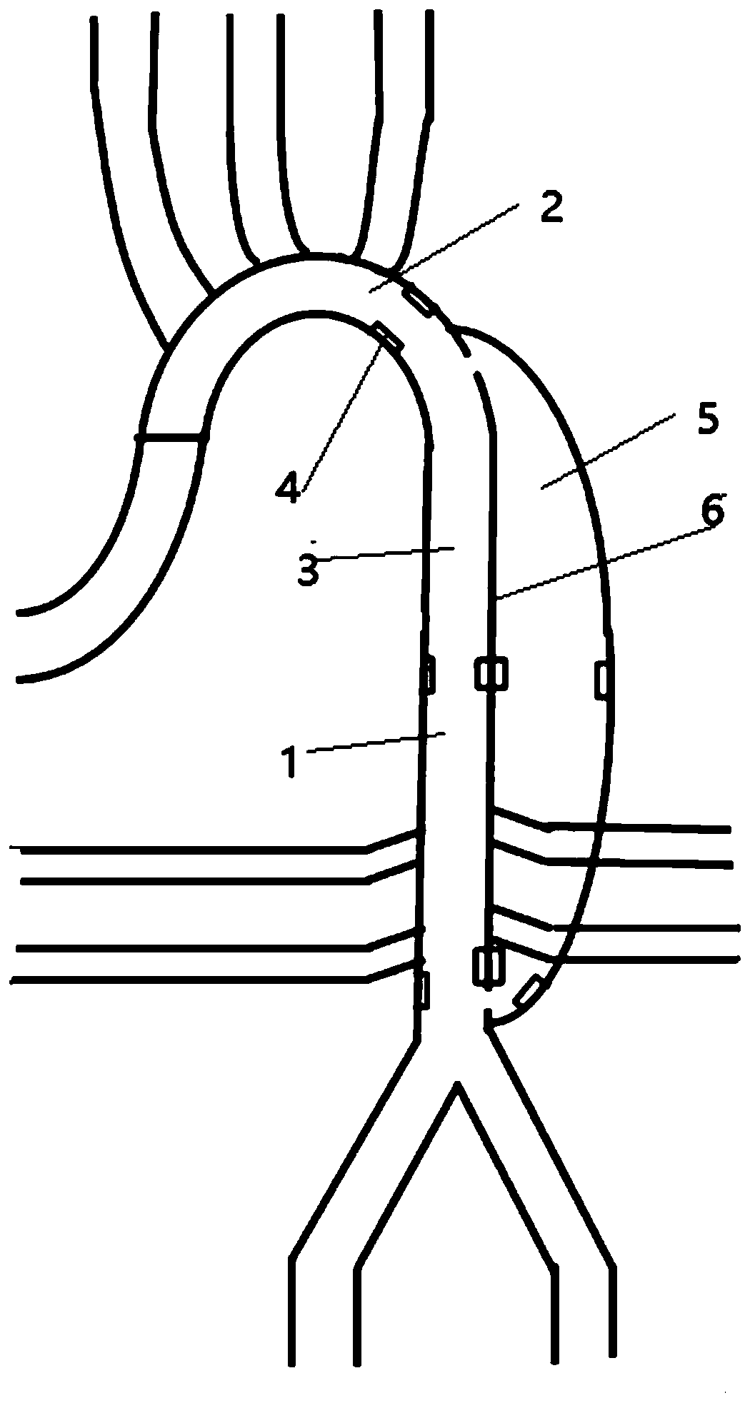 Model building method for dissection of aorta, model and surgery simulation detection method