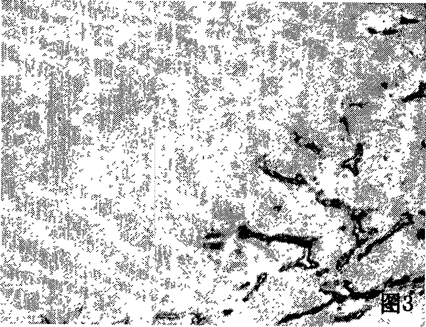 Production method of extracellular matrix engineered catheter containing olfactory ensheathing cells