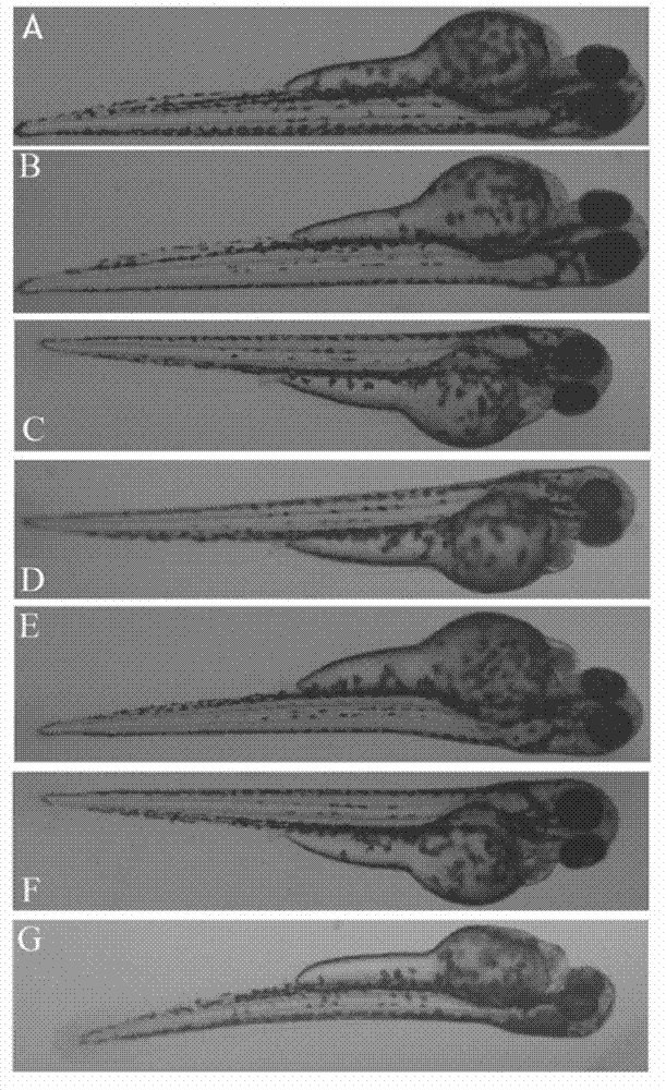 Application of terfenadine in preparation of zebra fish heart function damage model