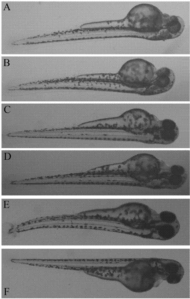 Application of terfenadine in preparation of zebra fish heart function damage model