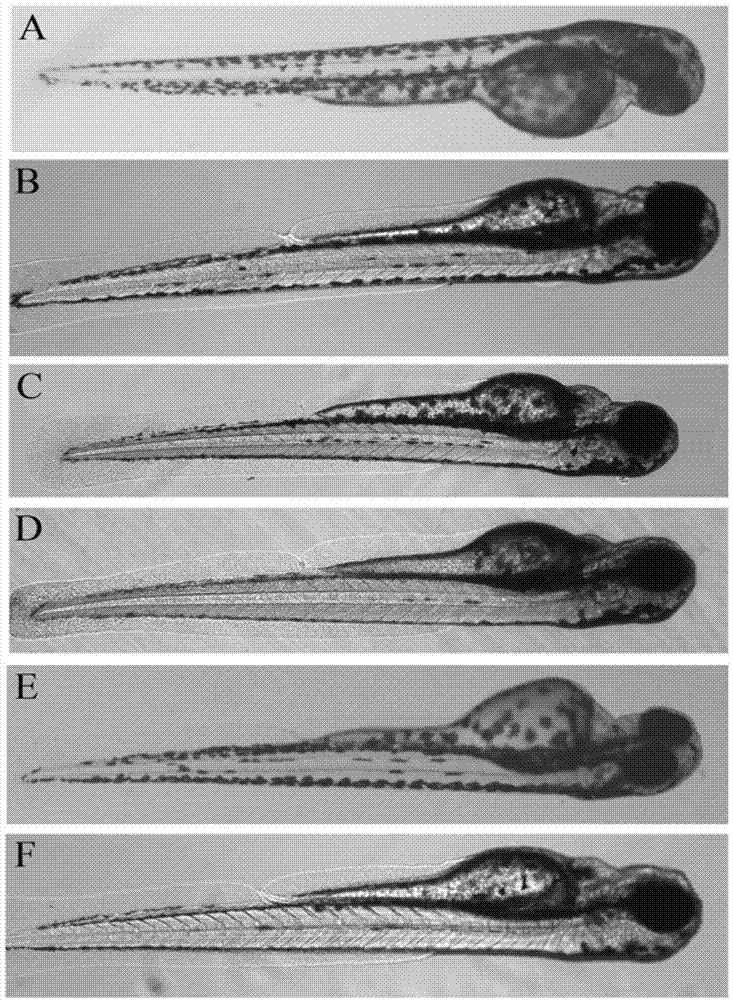 Application of terfenadine in preparation of zebra fish heart function damage model