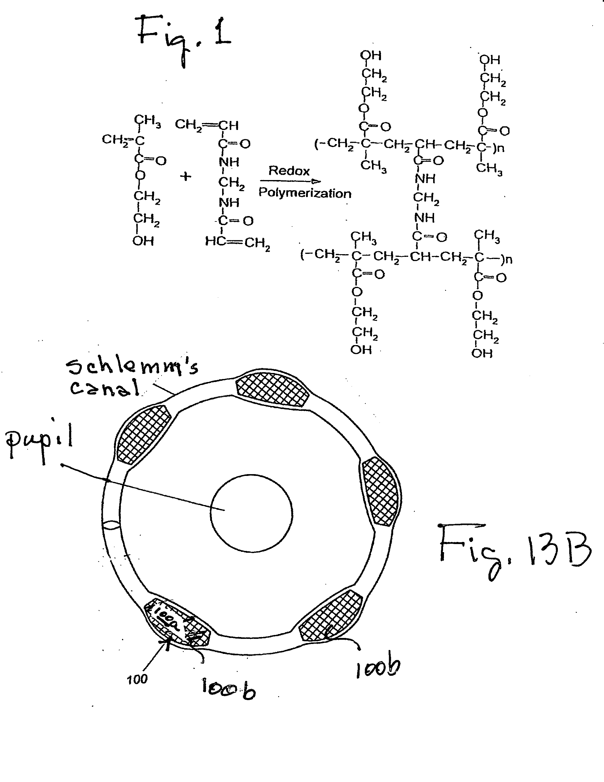 Device for delivery of antifibrotic agents & method