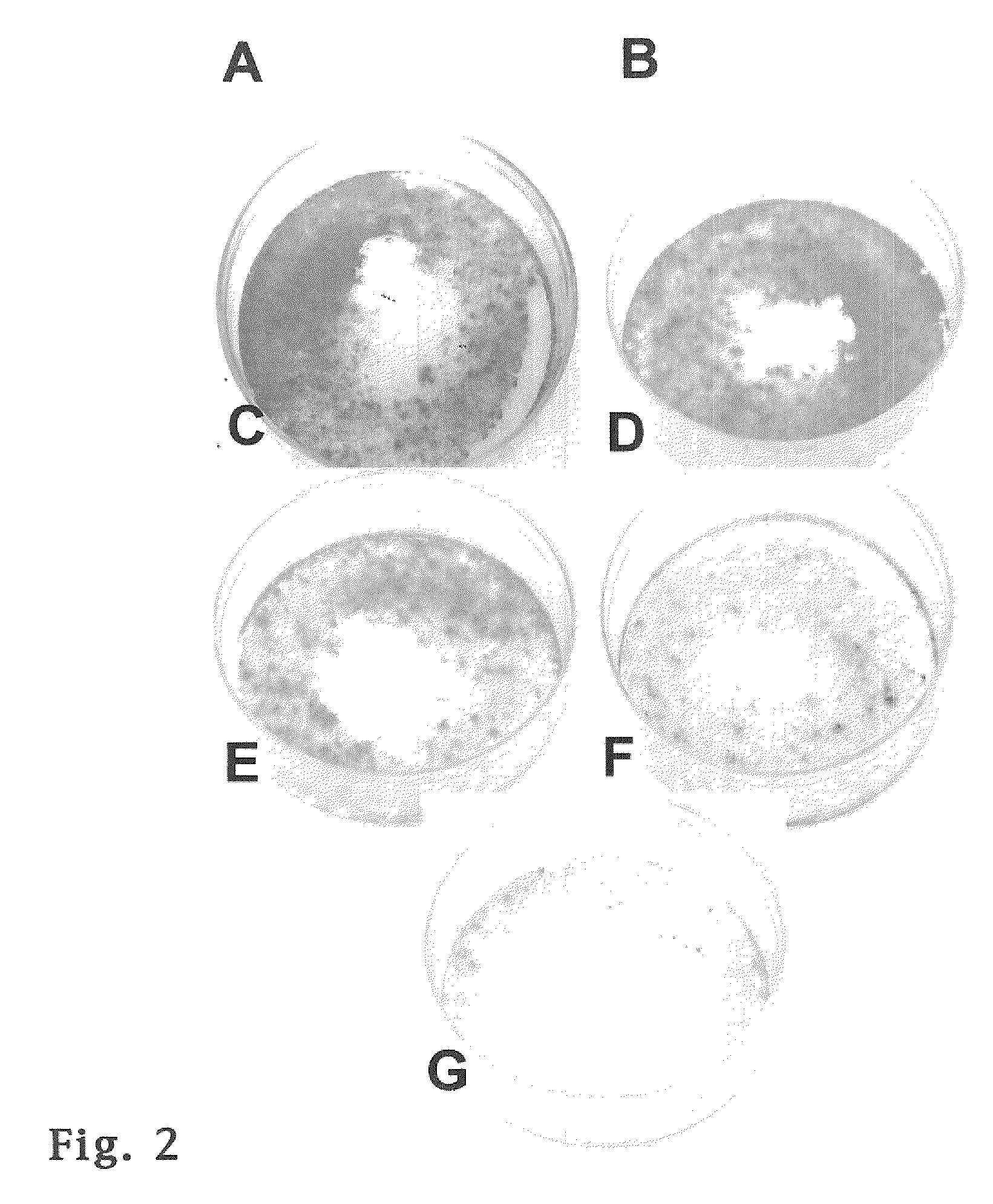 Device for delivery of antifibrotic agents & method
