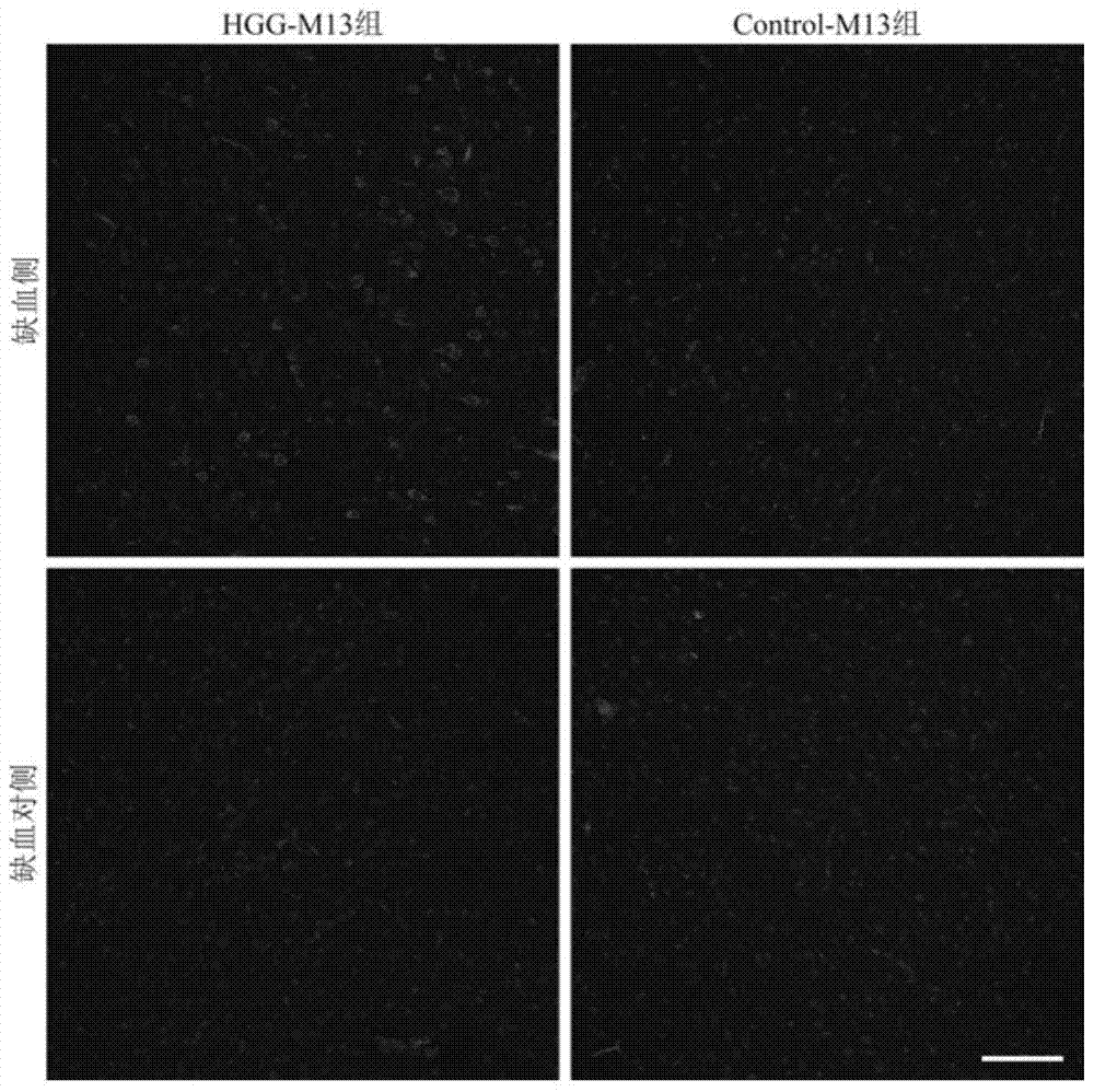 hgg polypeptide specifically binding to ischemic stroke tissue and its application