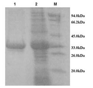 Colloidal gold test paper for rapidly detecting antibody of porcine reproductive and respiratory syndrome virus