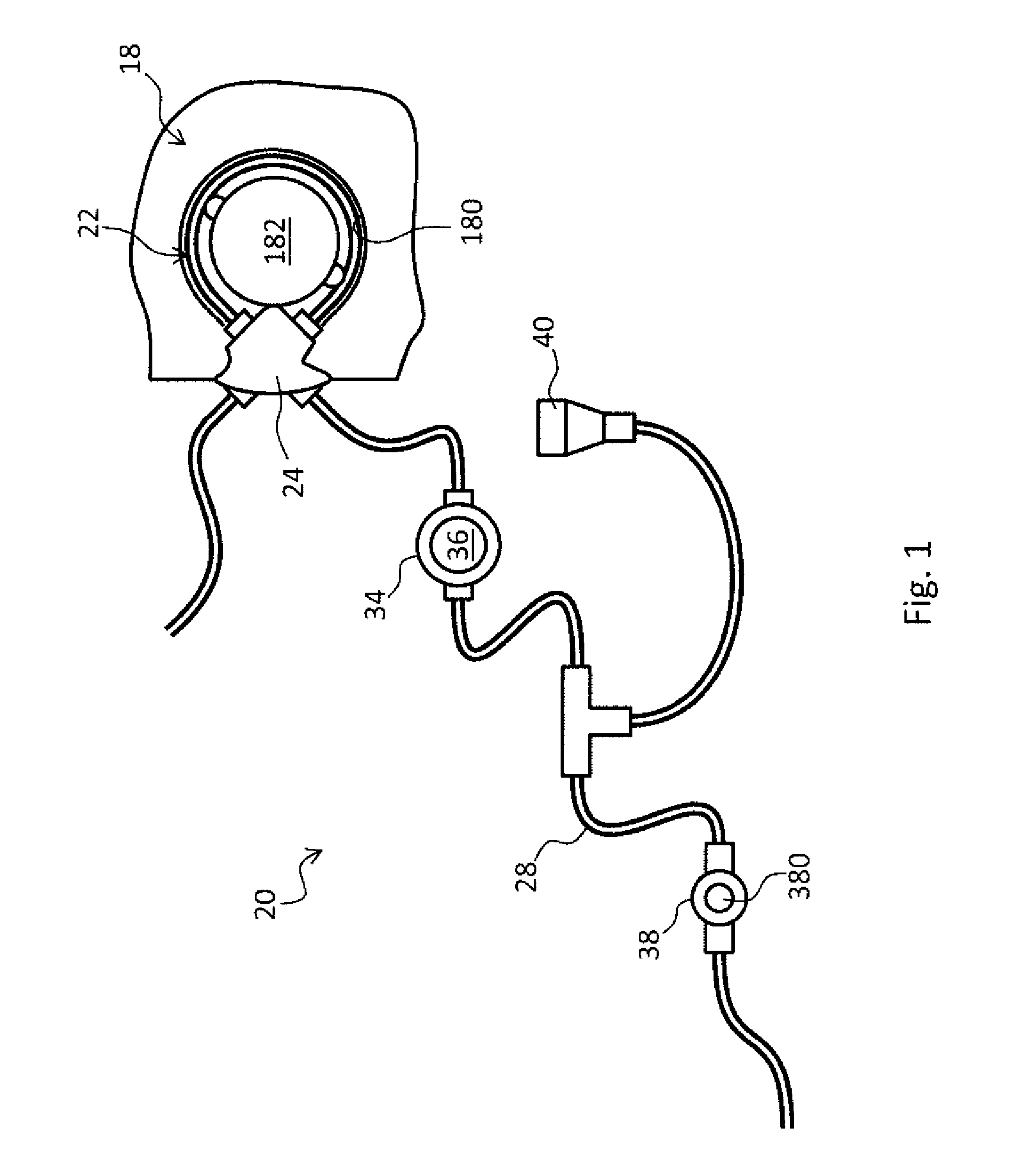 Tube for extra-corporeal circuit with double connector