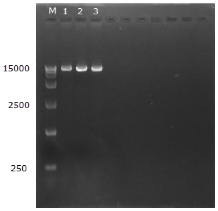 Cloning and application of Poa pratensis glutamine synthetase gene PpGS1.1 promoter