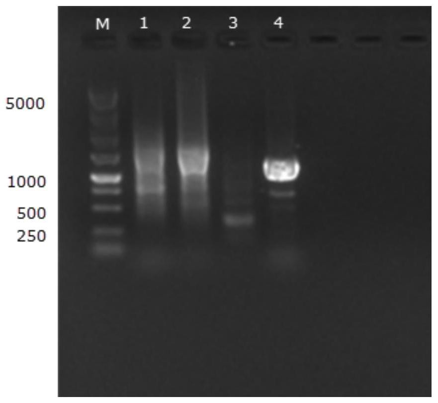 Cloning and application of Poa pratensis glutamine synthetase gene PpGS1.1 promoter