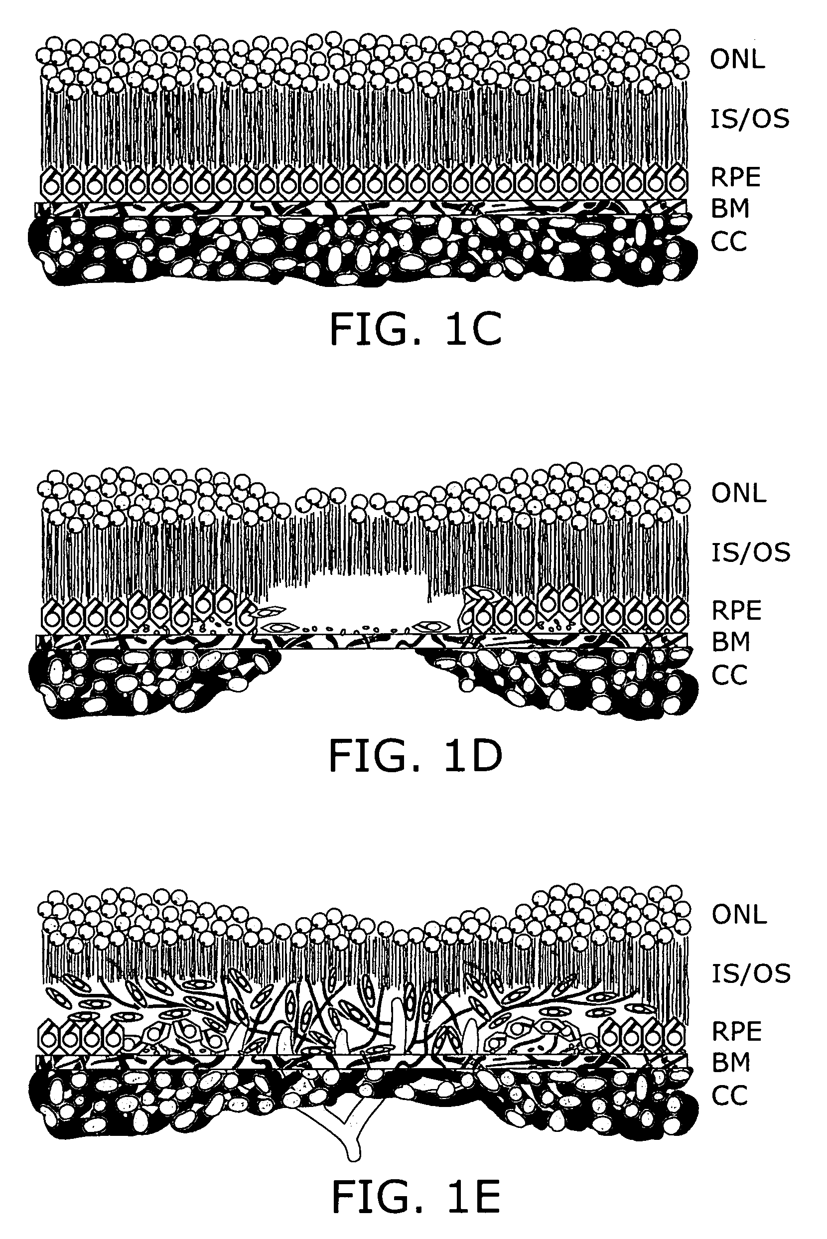 Compositions and methods for treatment of macular degeneration and related conditions