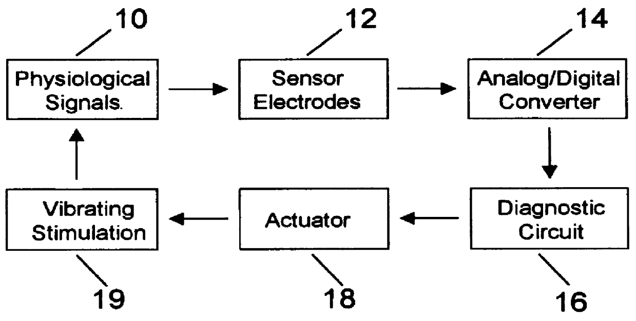 Arrangement for monitoring physiological signals