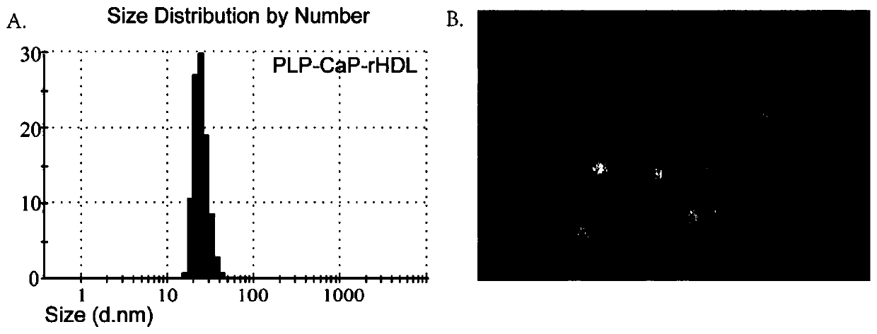 Glucocorticoid-loaded nano-carrier as well as preparation and application thereof