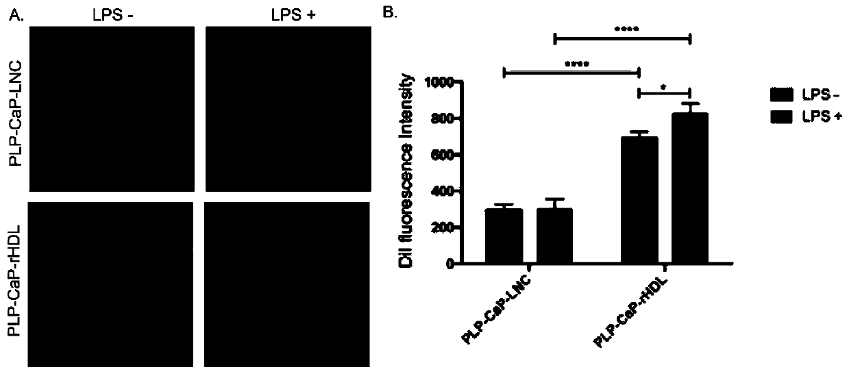 Glucocorticoid-loaded nano-carrier as well as preparation and application thereof