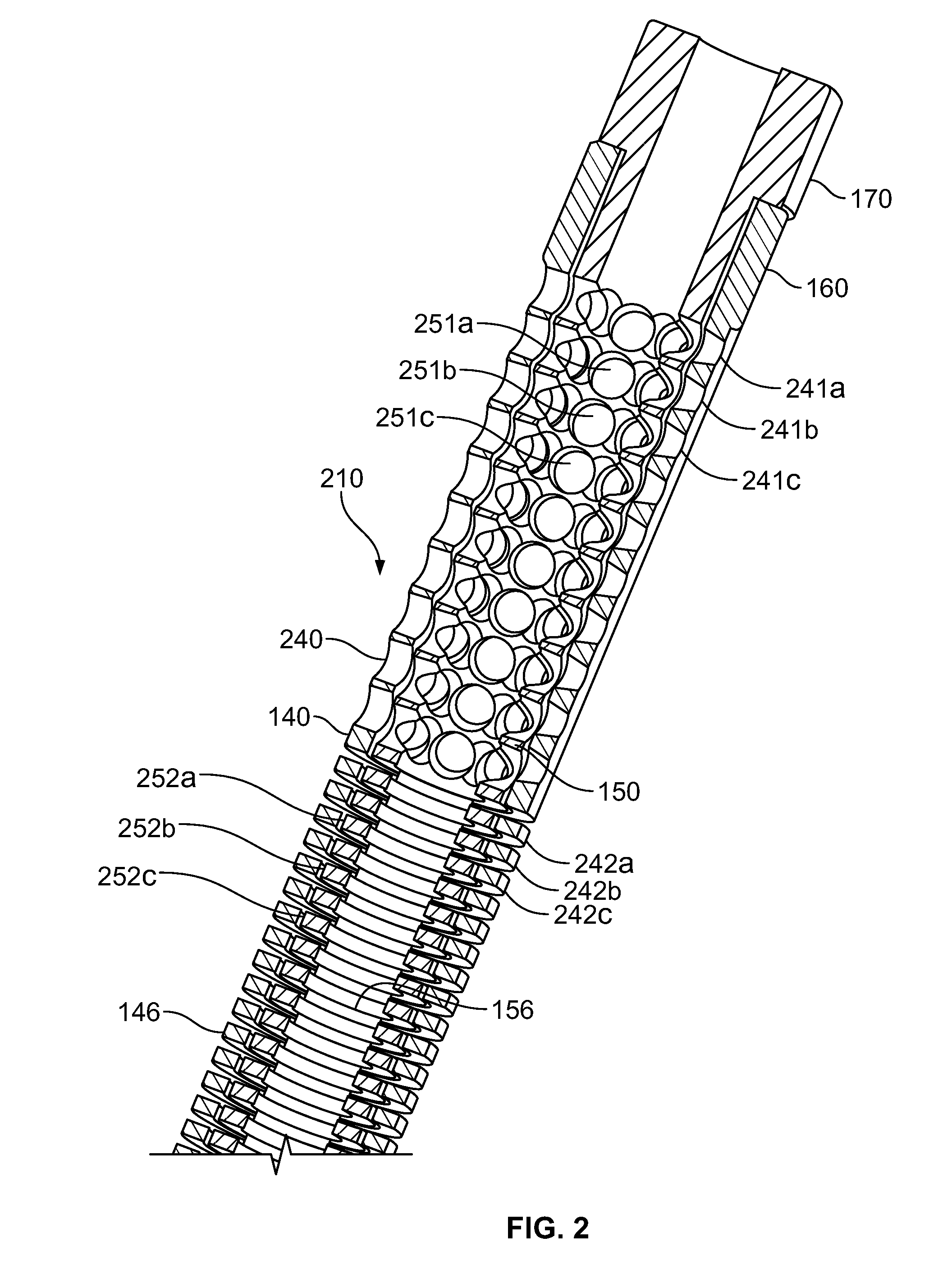 Rotary-rigid orthopaedic rod