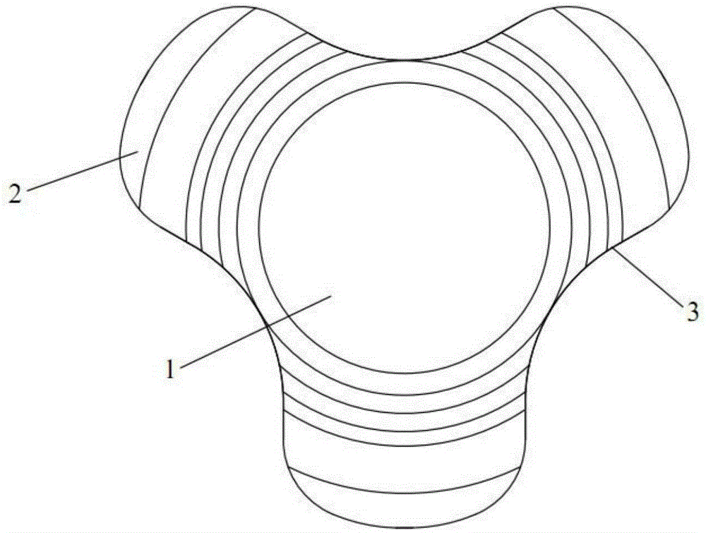 Special-shaped sclera lens