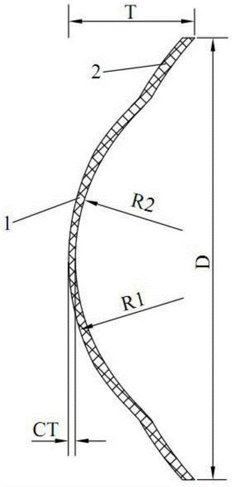 Special-shaped sclera lens