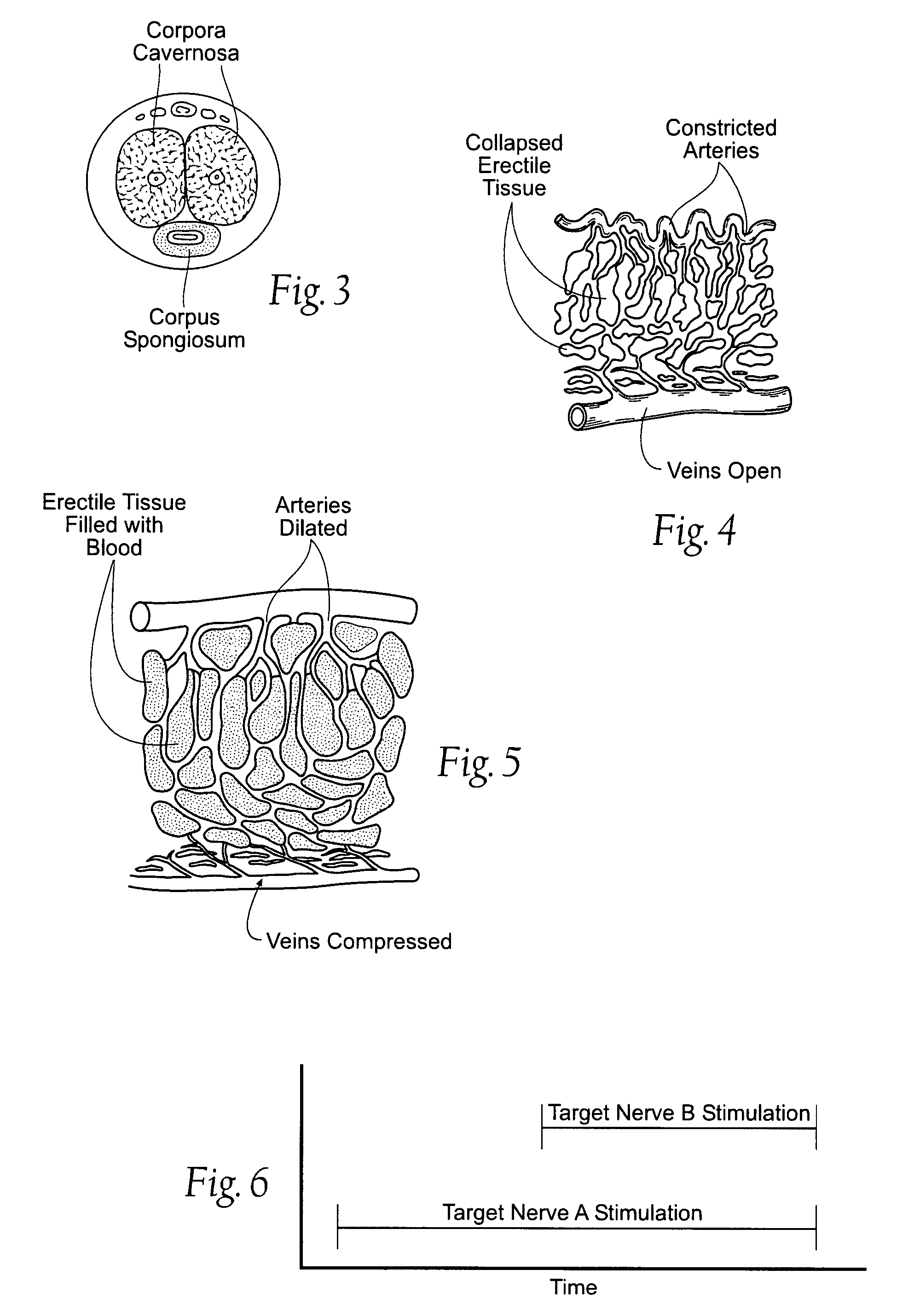 Systems and methods of neuromodulation stimulation for the restoration of sexual function