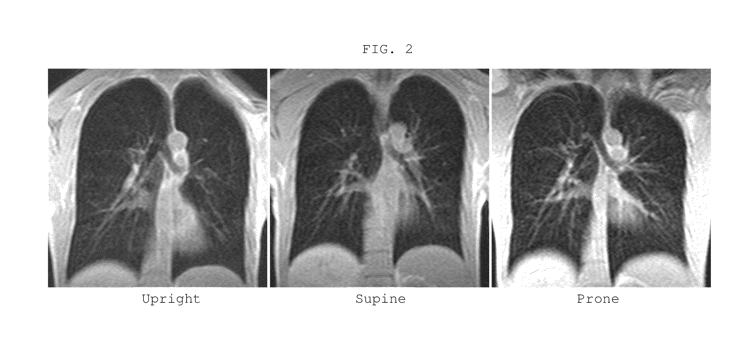 Method and system for performing upright magnetic resonance imaging of various anatomical and physiological conditions