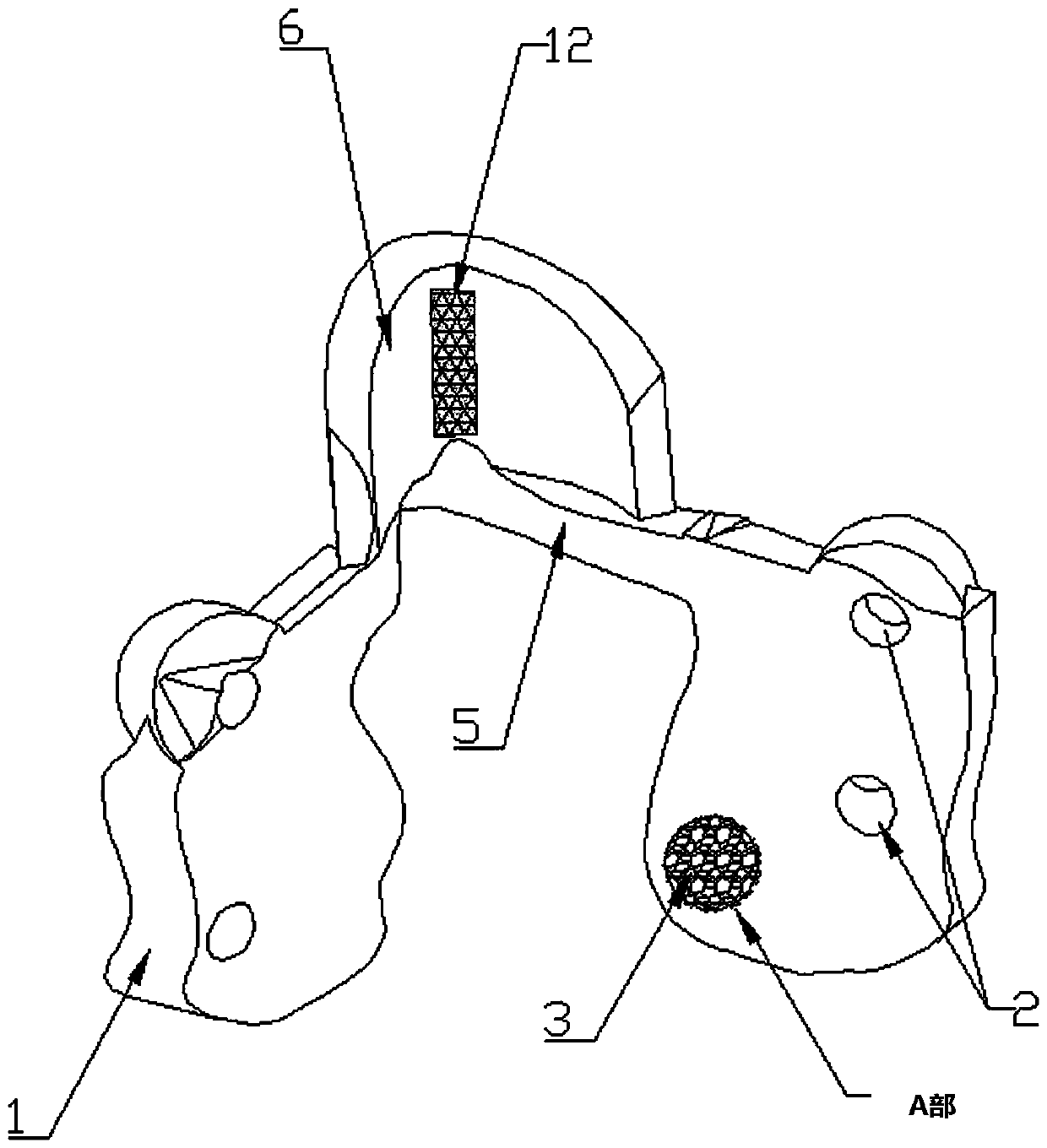 3D printing occipitocervical fusion fixing device