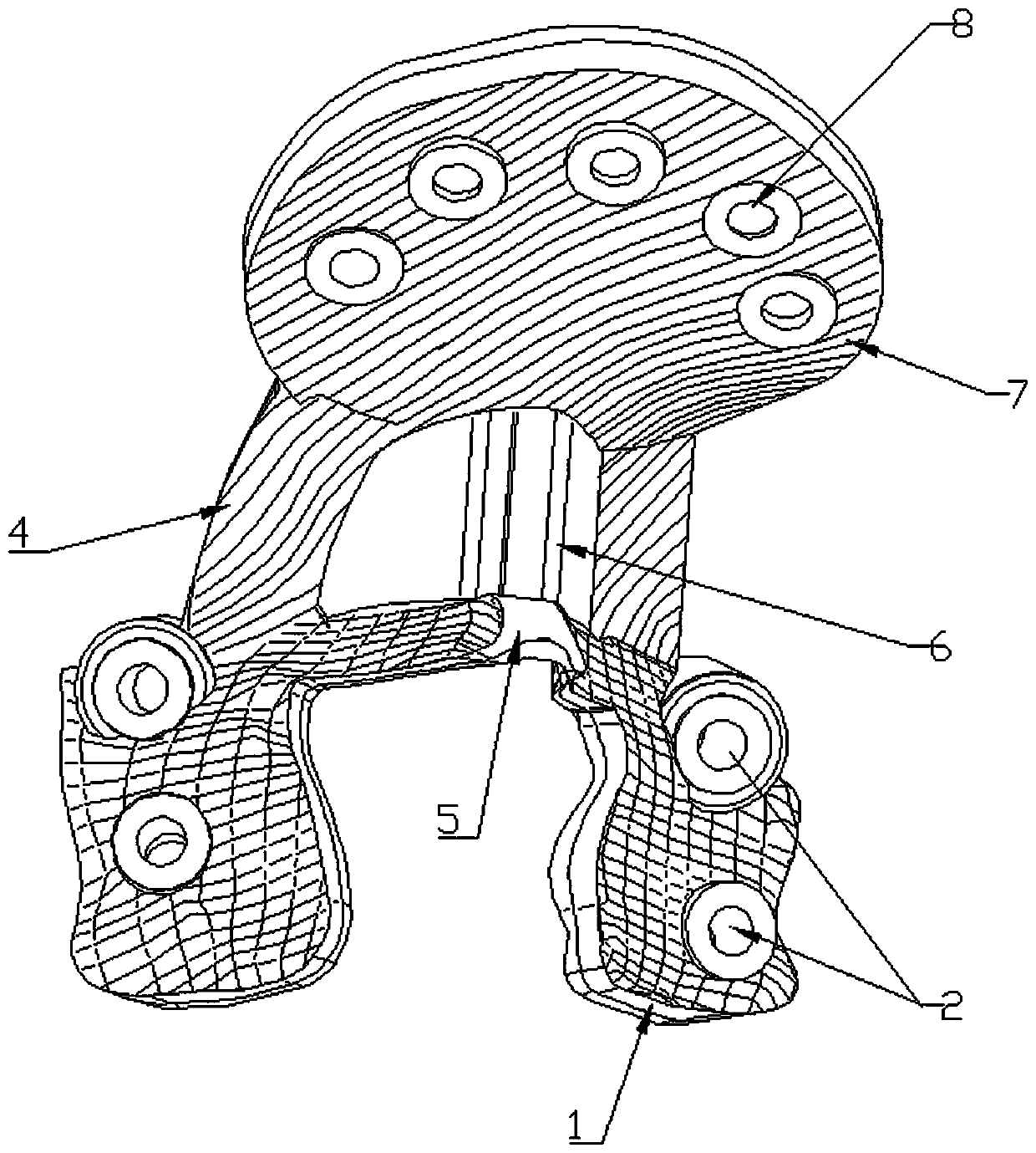 3D printing occipitocervical fusion fixing device