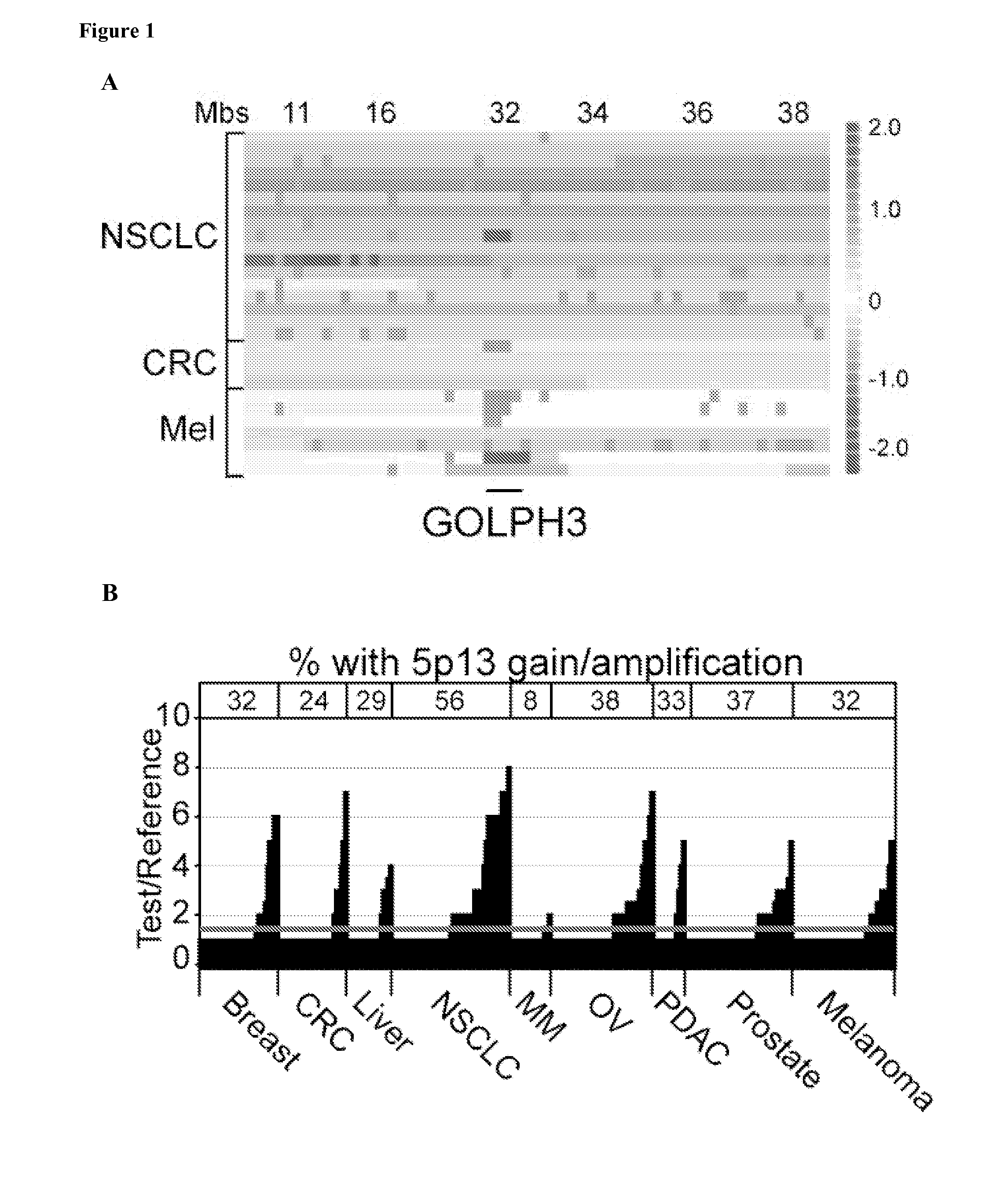 Compositions, Kits, and Methods for the Diagnosis, Prognosis, and Monitoring of Cancer Using GOLPH3