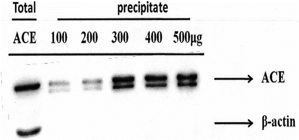 Novel method for screening angiotensin invertase inhibitor