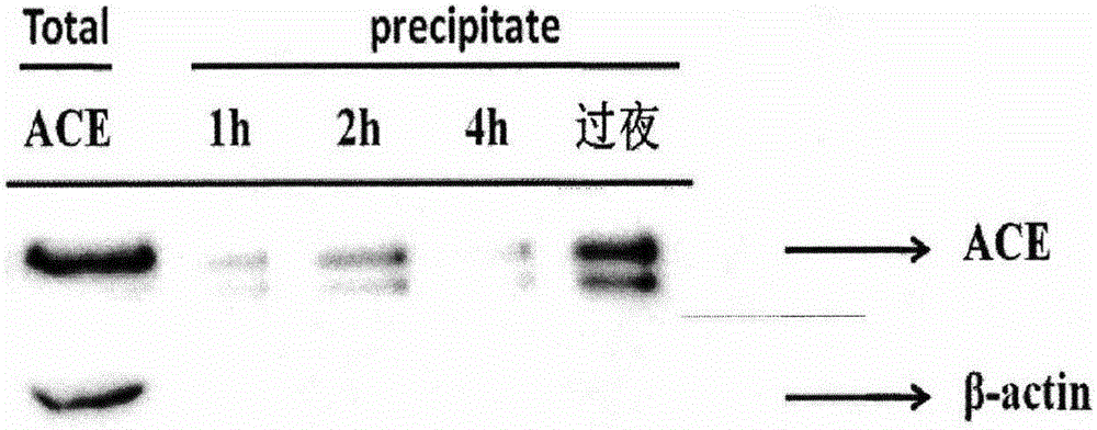 Novel method for screening angiotensin invertase inhibitor