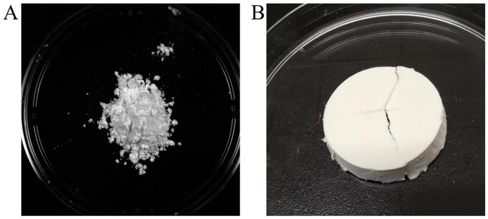 Acellular matrix particle compounded with human mesenchymal stem cell culture supernatant component as well as preparation method and application of acellular matrix particle