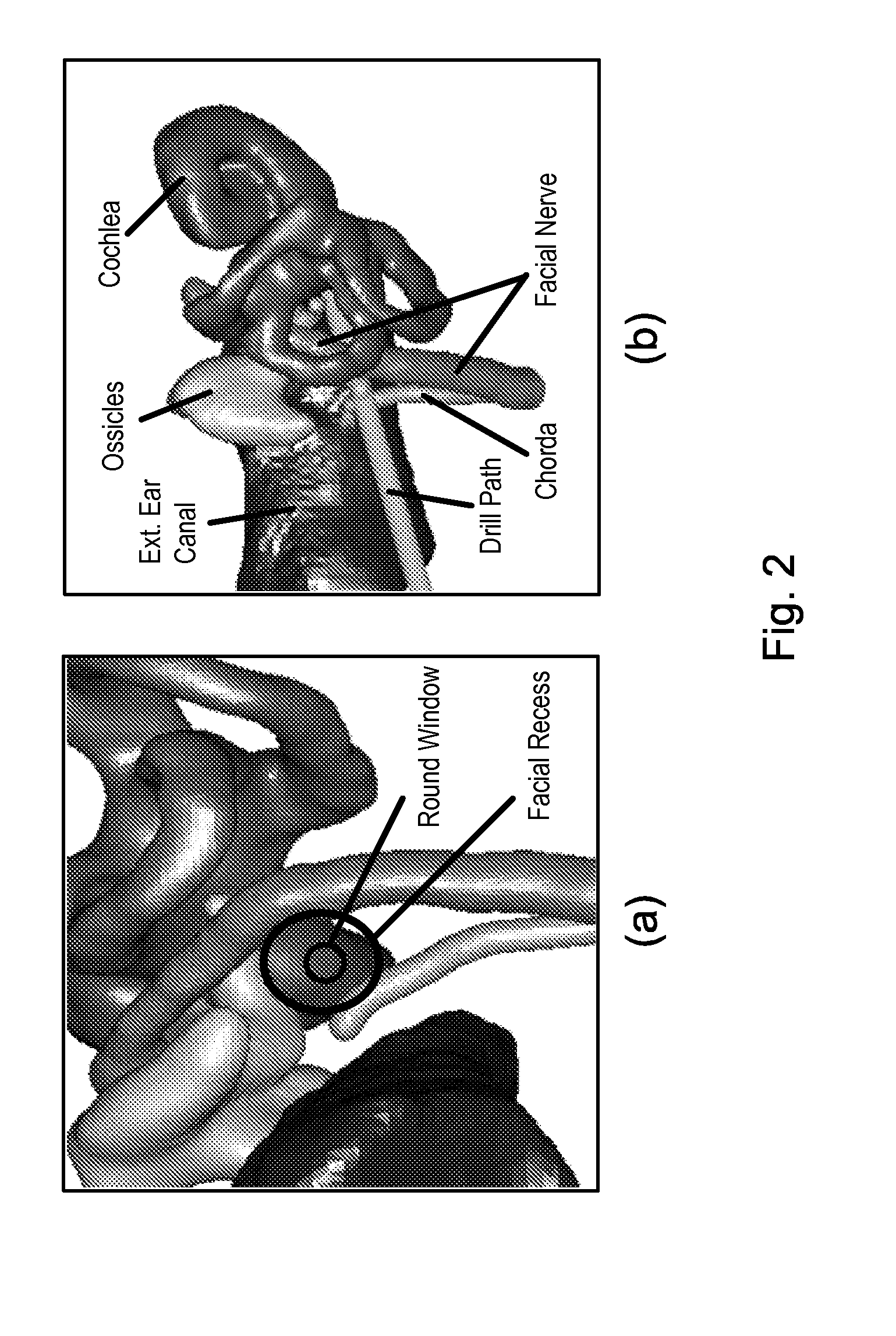System and methods for automatic segmentation of one or more critical structures of the ear