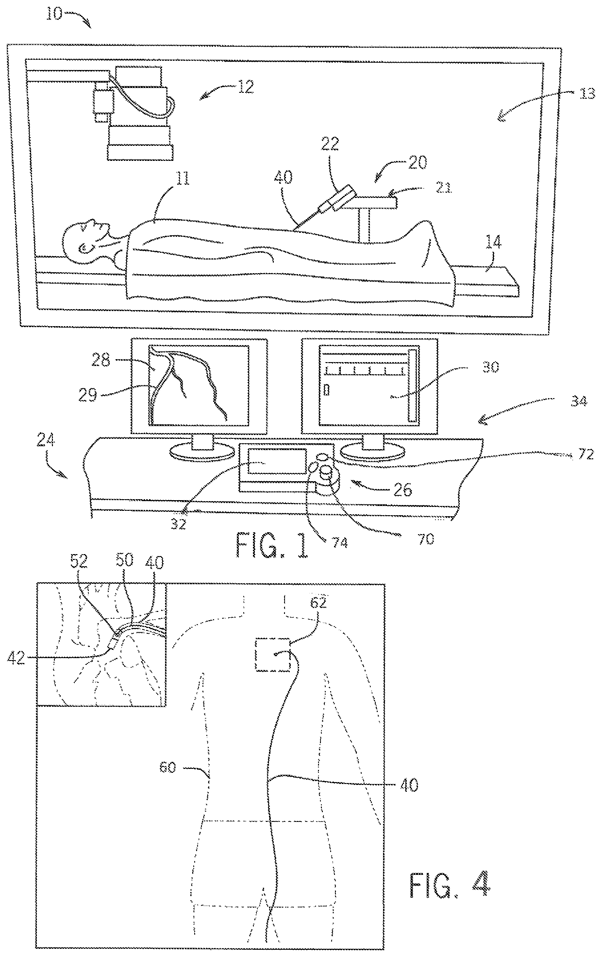 System and method for monitoring of guide catheter seating