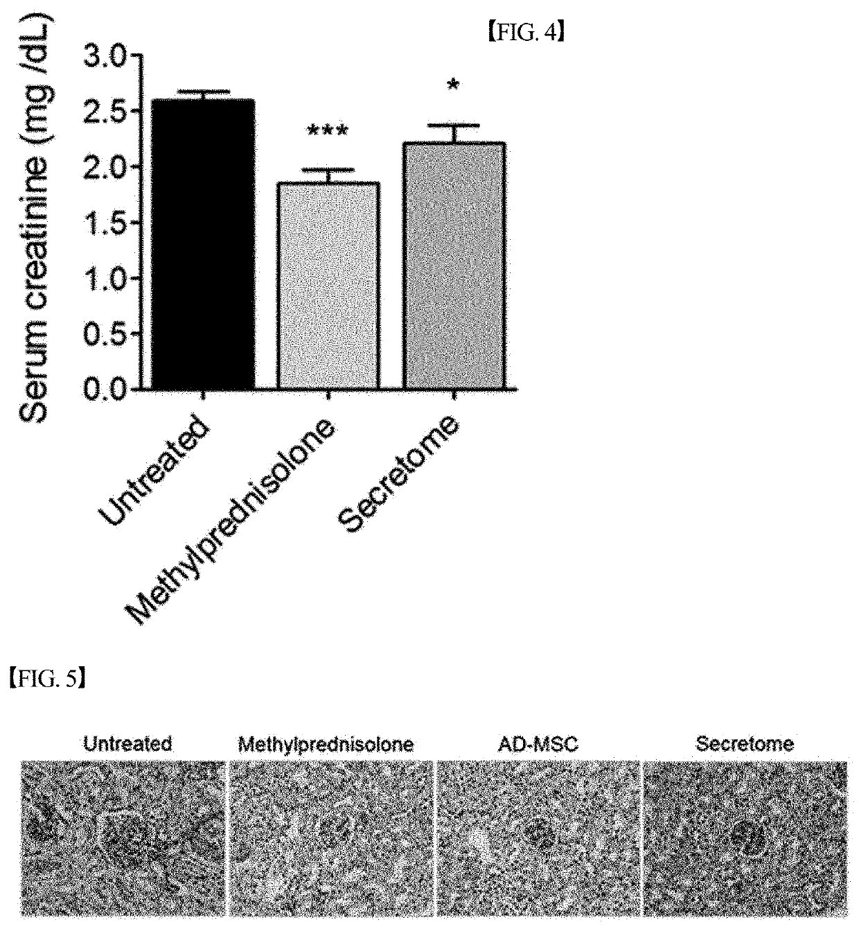 Pharmacological Composition for Prevention or Treatment of Lupus, Comprising Mesenchymal Stem Cell-Derived Secretome