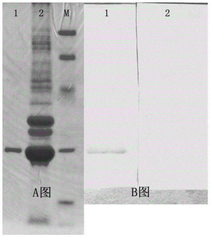 Brucella omp31 antigenic epitope and monoclonal antibody thereof, and application of brucella omp31 antigenic epitope and monoclonal antibody thereof