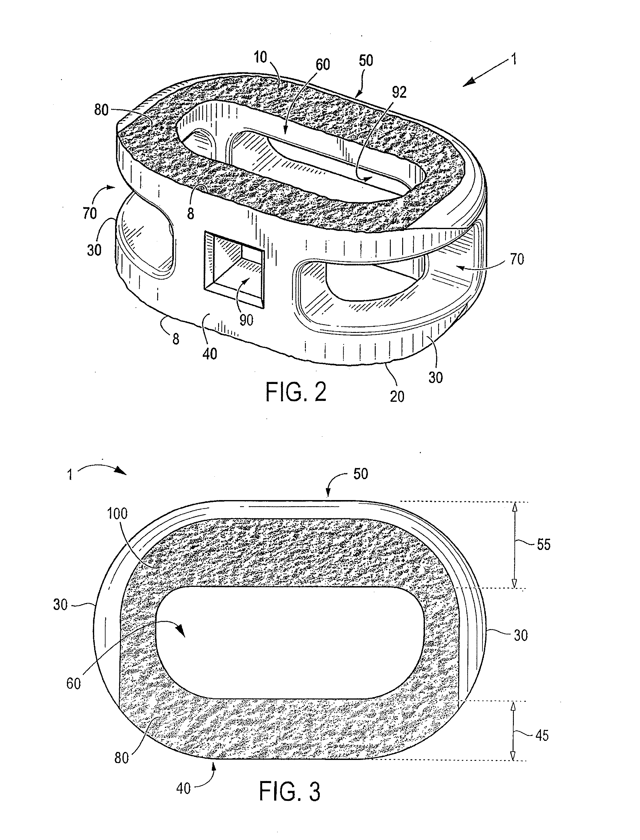Friction-fit spinal endplate and endplate-preserving method