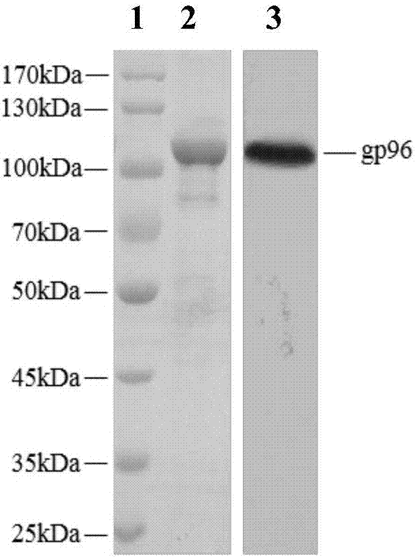 Application of gp96 protein to preparation of medicine for treating idiopathic thrombocytopenic purpura