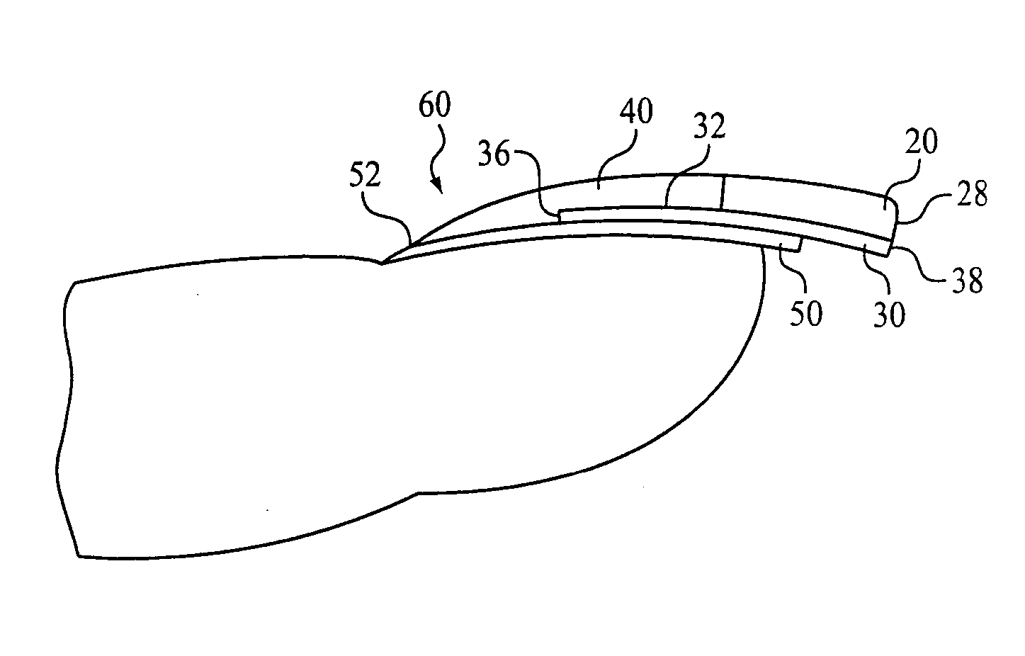 Fingernail accessory and method of forming an artificial fingernail