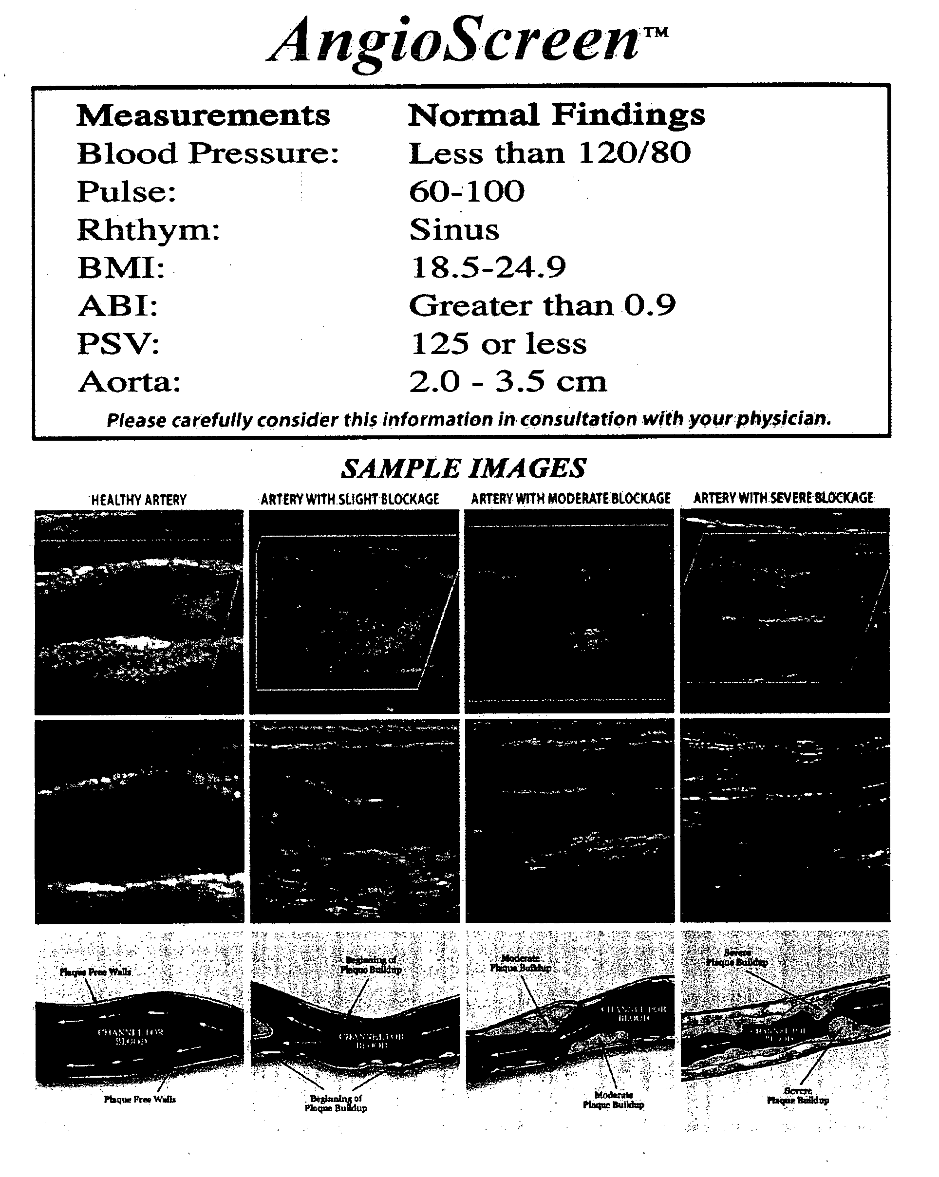 Systems and methods for health screening for vascular disease