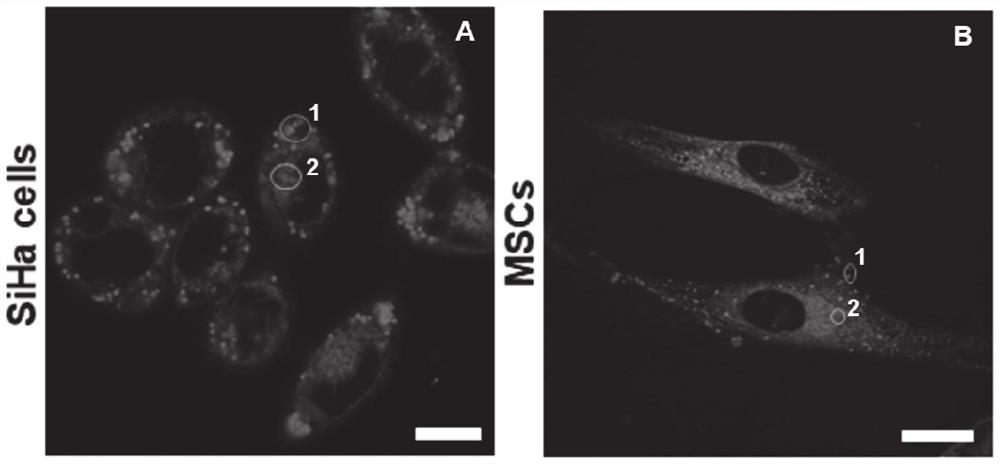 Single-molecule fluorescent probe capable of simultaneously imaging lipid droplets and endoplasmic reticulum in two colors and application of single-molecule fluorescent probe