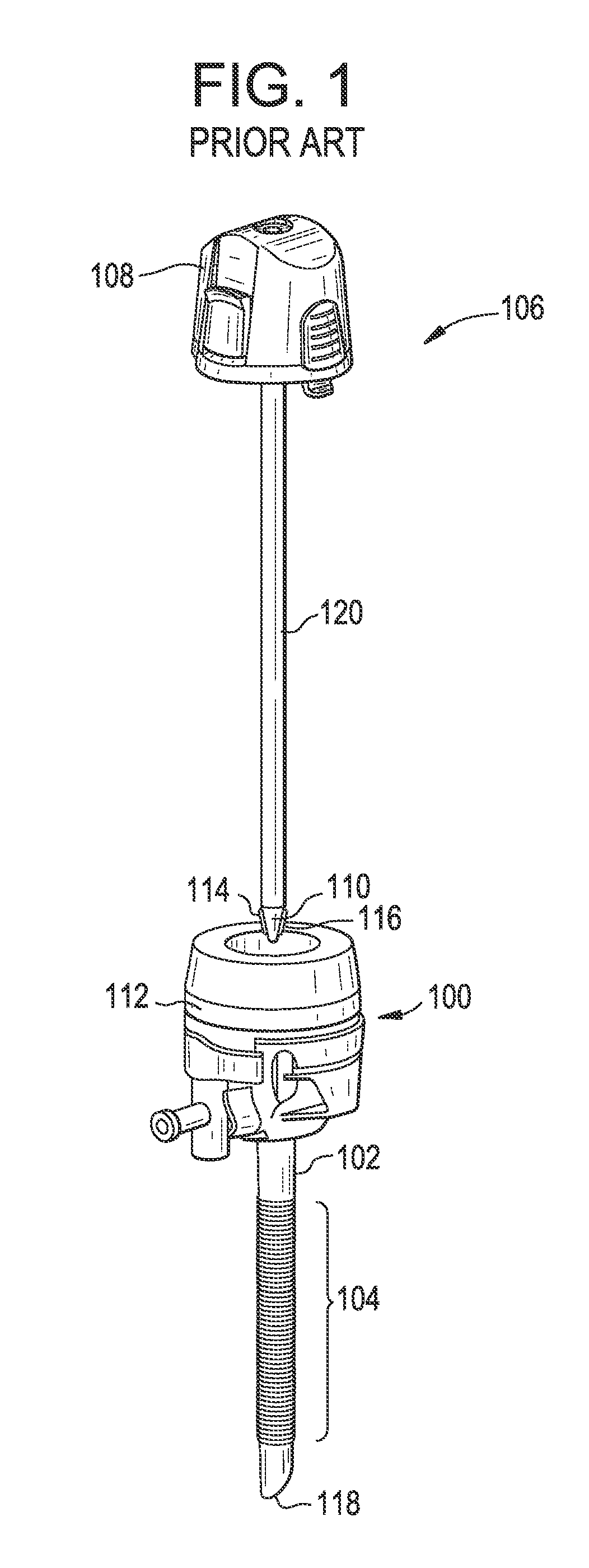 Device For Anchoring a Trocar