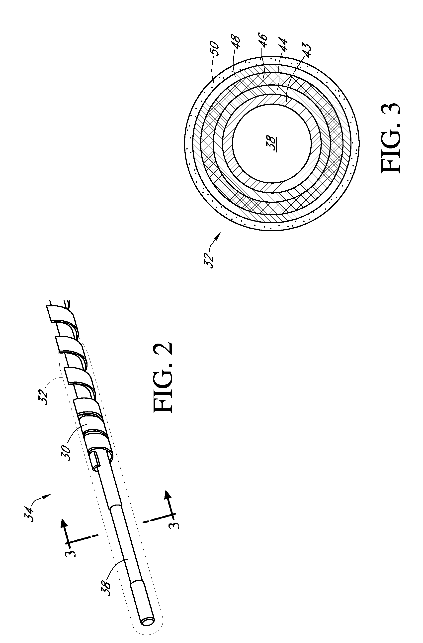 Particle-containing membrane and particulate electrode for analyte sensors