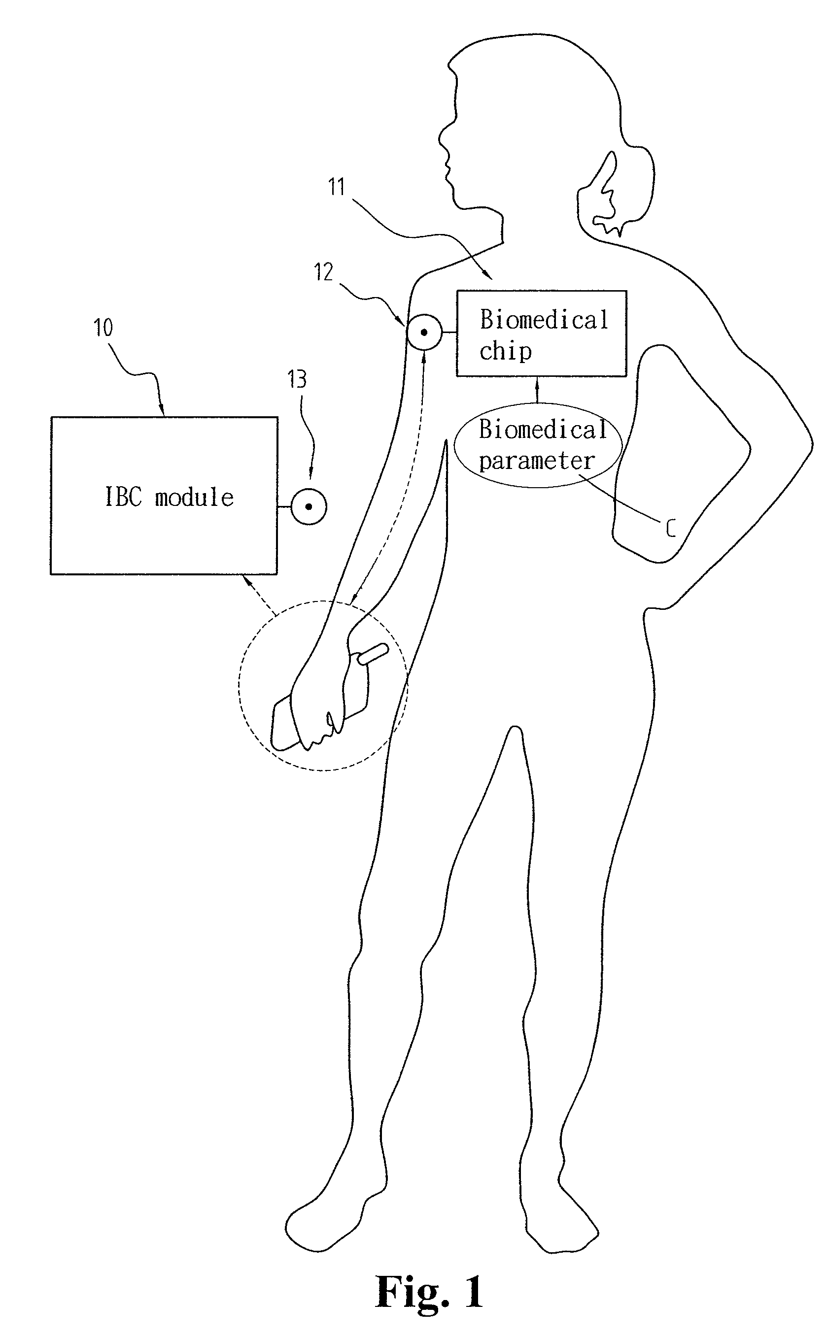 Intra-body communication (IBC) device and a method of implementing the IBC device