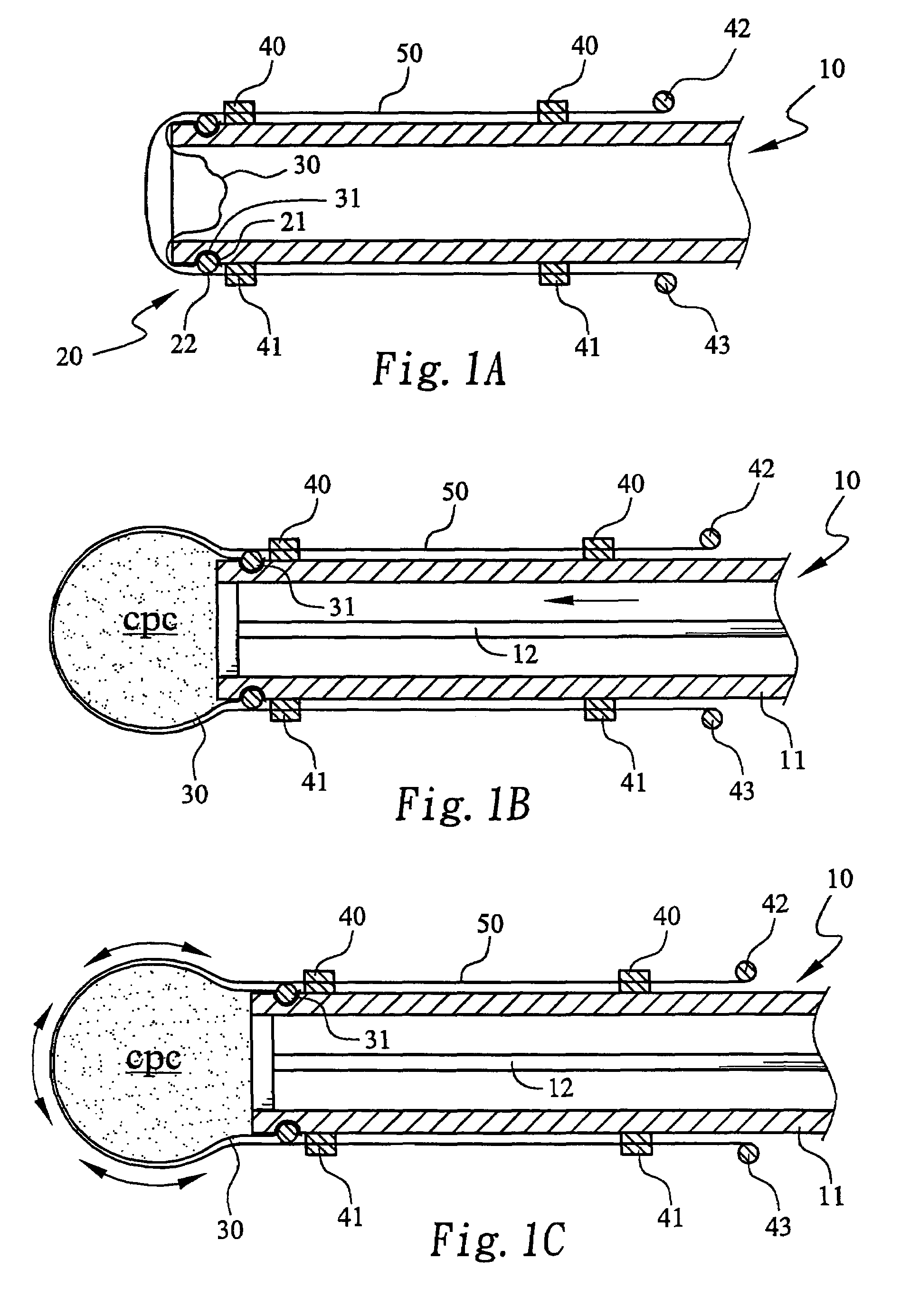 Method for forming a hardened cement in a bone cavity