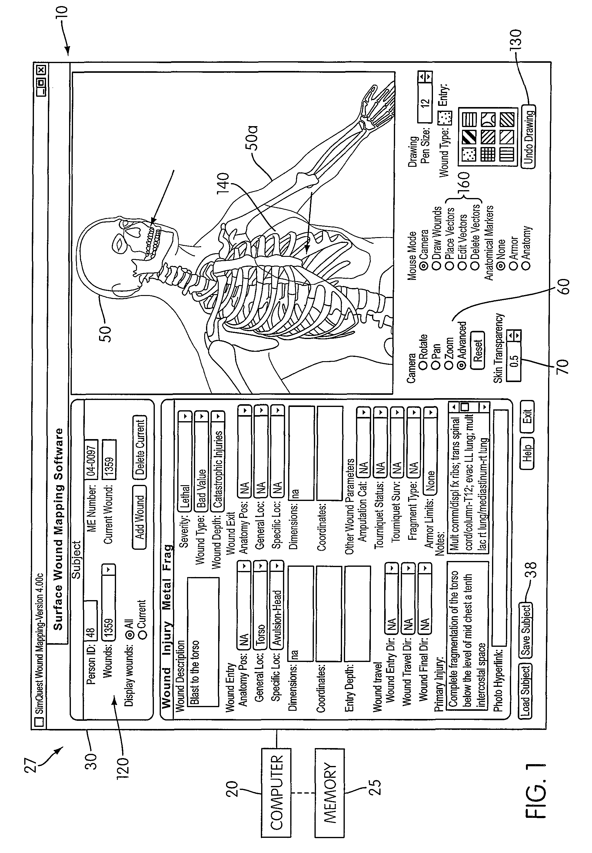 Method and apparatus for collecting and analyzing surface wound data