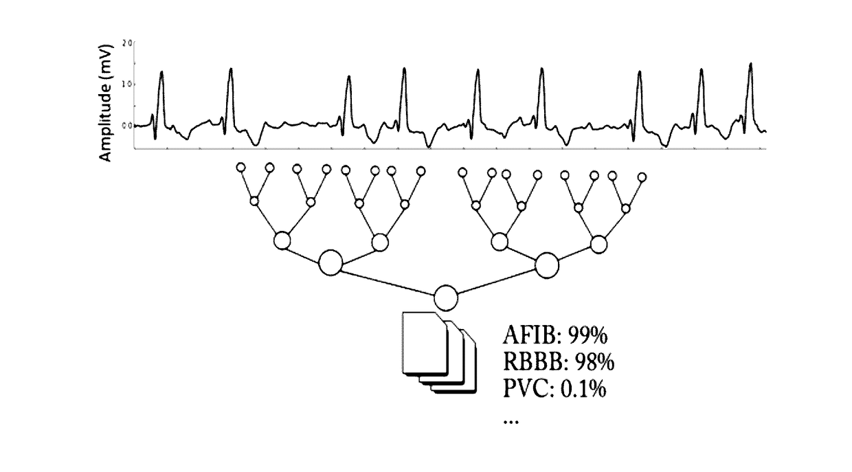 Automatic method to delineate or categorize  an electrocardiogram