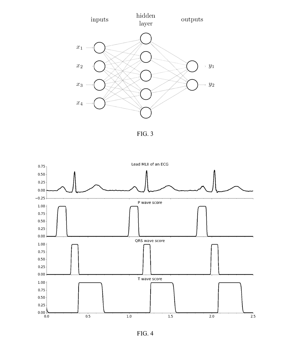 Automatic method to delineate or categorize  an electrocardiogram