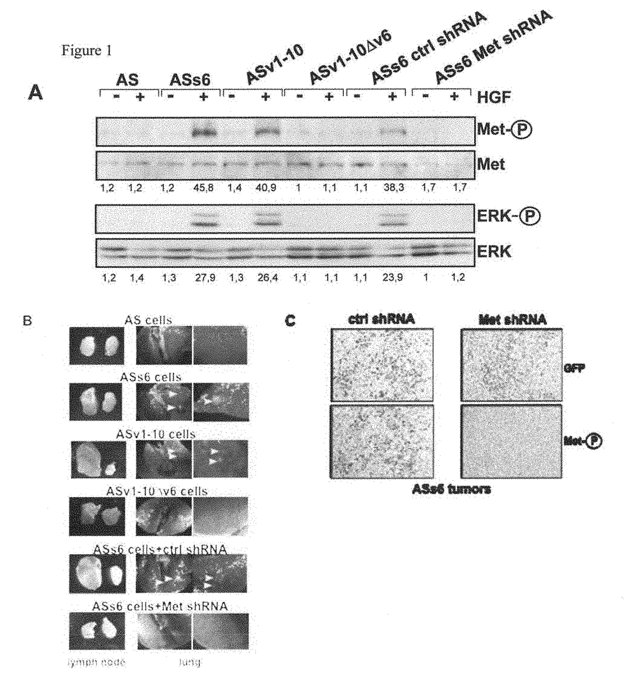 CD44V6-Derived Peptides for Treating Metastasizing Cancer