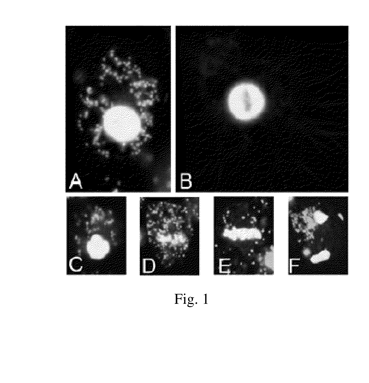 Compositions and Methods employing Wolbachia FtsZ as a target for Albendazole sulfone