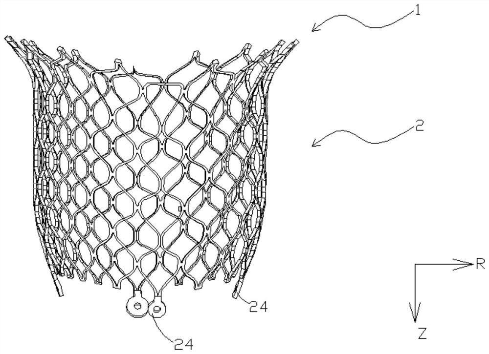 A transcatheter mitral valve stent