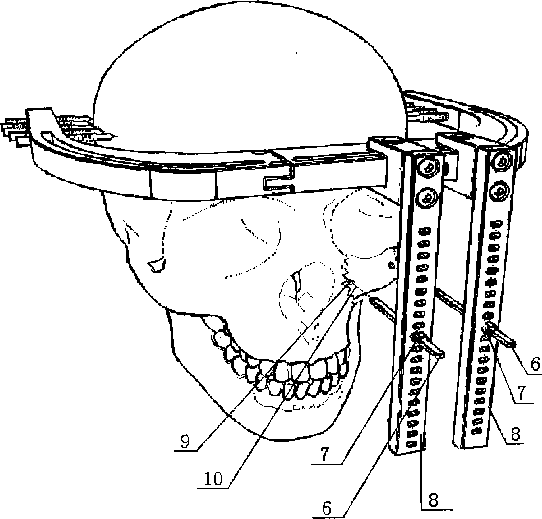Adjustable mid-face bone tractor and design method thereof