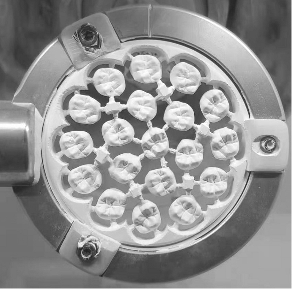 Laminated zirconia dental ceramic material and preparation method thereof